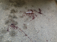 اللد: إصابة شاب اثر تعرضه لعملية طعن في شارع رمات اشكول